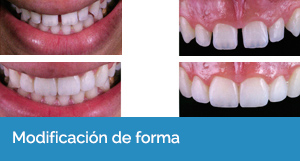 estética dental en Sevilla